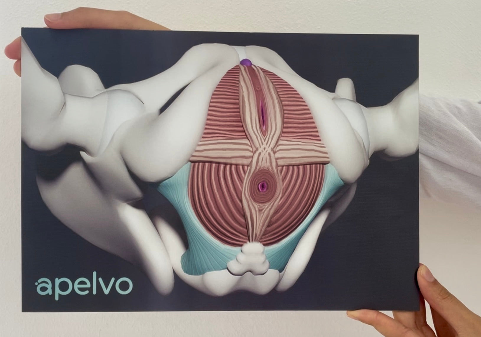 3D-Beckenboden-Visualisierung (Lentikulardruck)