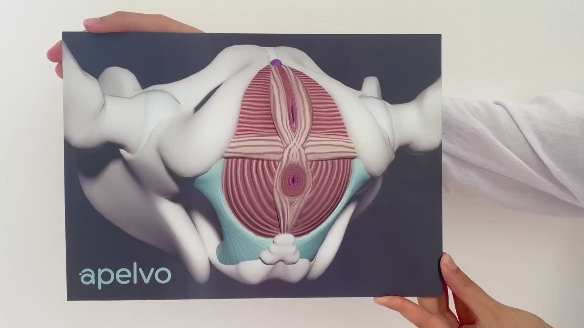3D-Beckenboden-Visualisierung (Lentikulardruck)